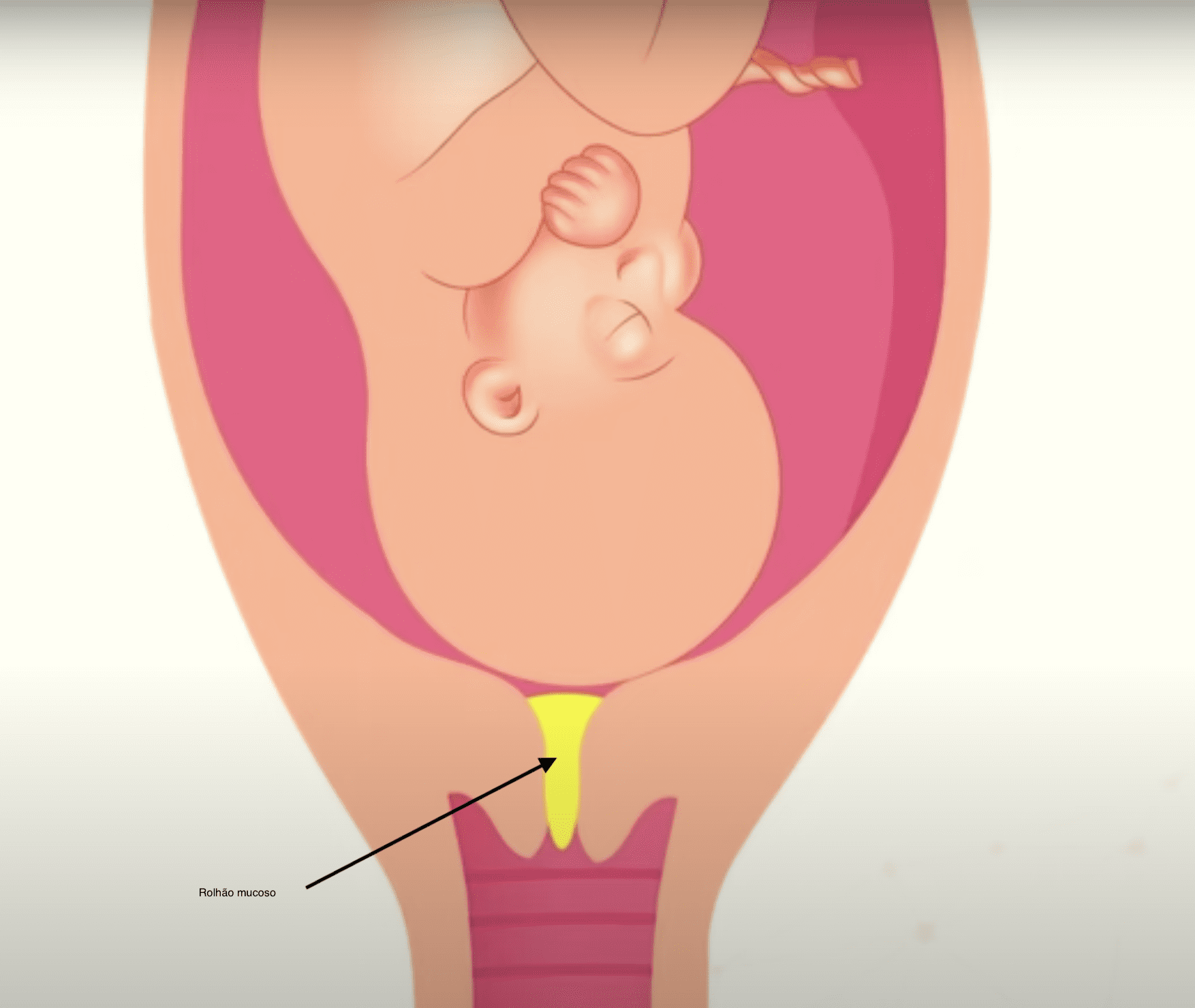 O Que é O Rolhão Mucoso E Para Que Serve 