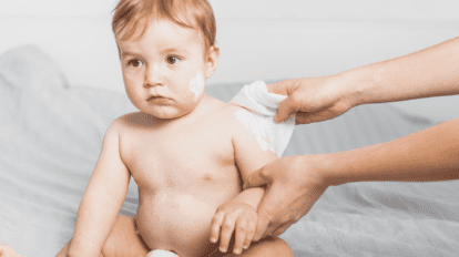 Cuidados à pele atópica nos bebés